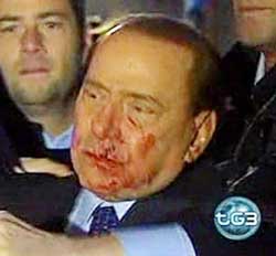 Aggressione Berlusconi